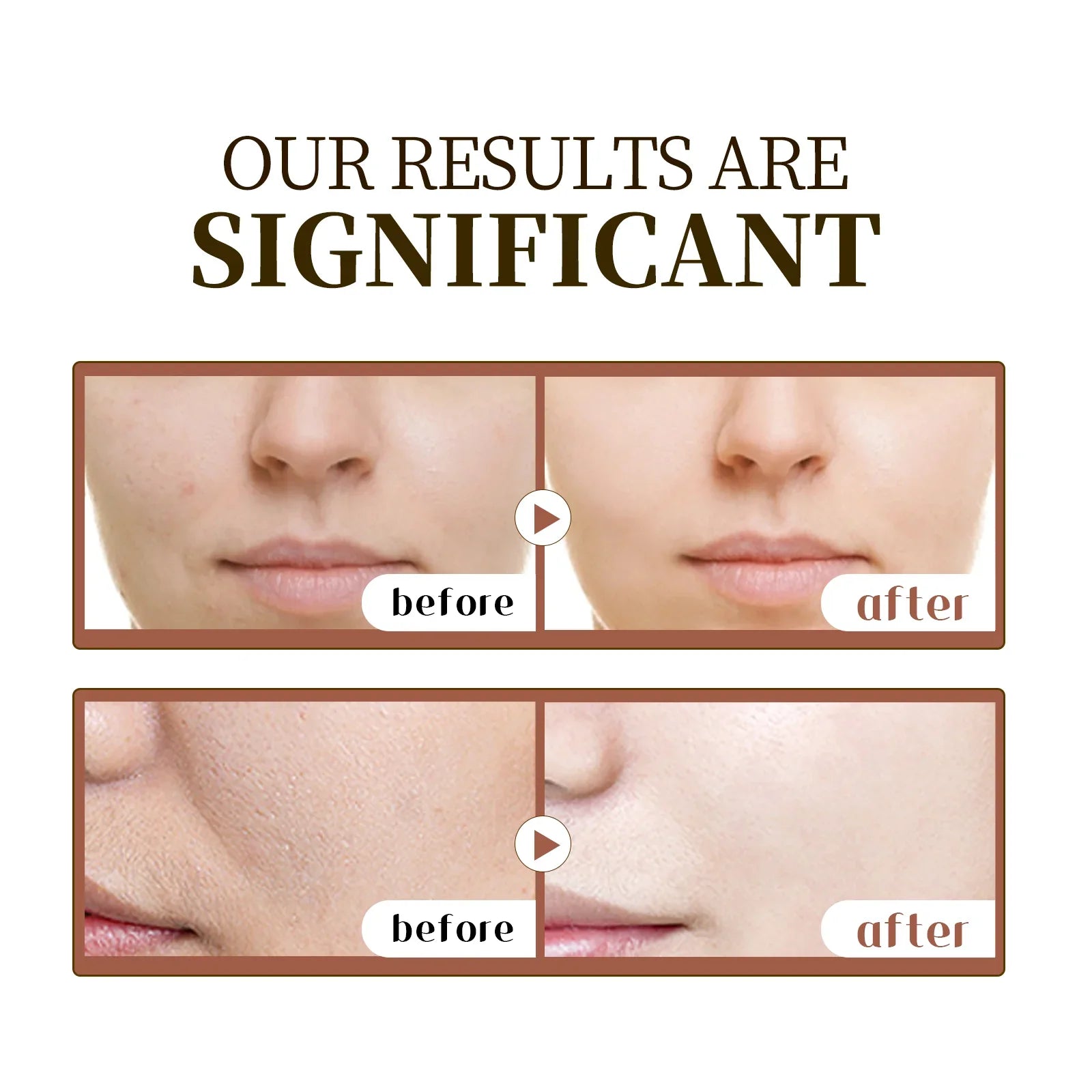 Madagascar Skin Comfort Serum